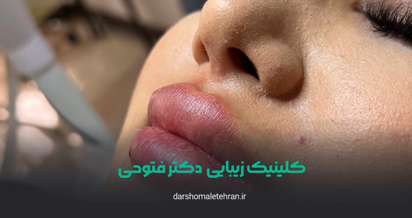 تزریق ژل دکتر سمانه فتوحی شهرک غرب