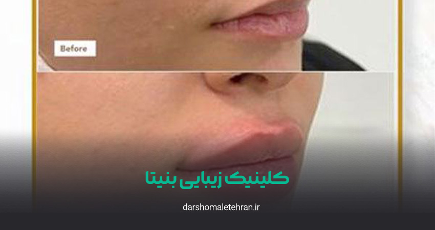کلینیک زیبایی بنیتا زعفرانیه