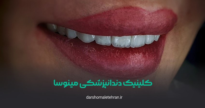 کلینیک دندانپزشکی شبانه‌روزی مینوسا میرداماد