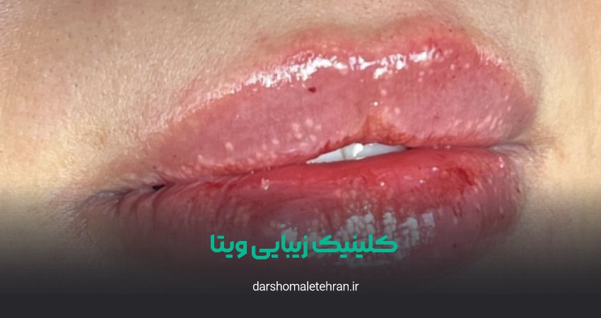 کلینیک زیبایی ویتا هروی