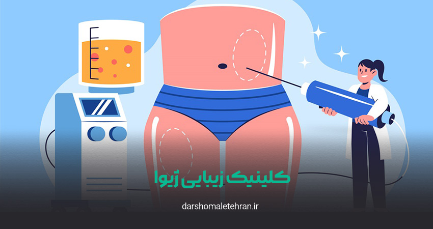 کلینیک زیبایی ژیوا شهرک غرب