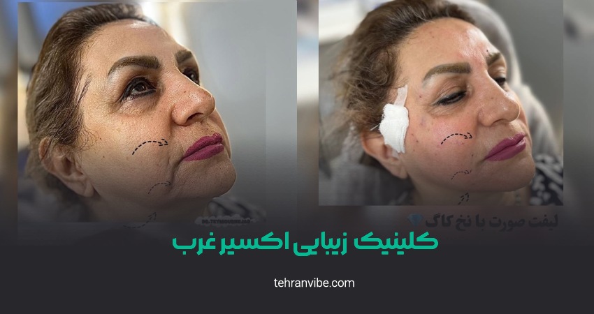 کلینیک زیبایی اکسیرغرب شهران