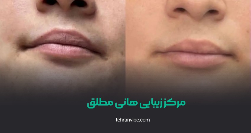 کلینیک زیبایی هانیه مطلق تهران ویلا