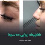 کلینیک زیبایی مه سیما صادقیه