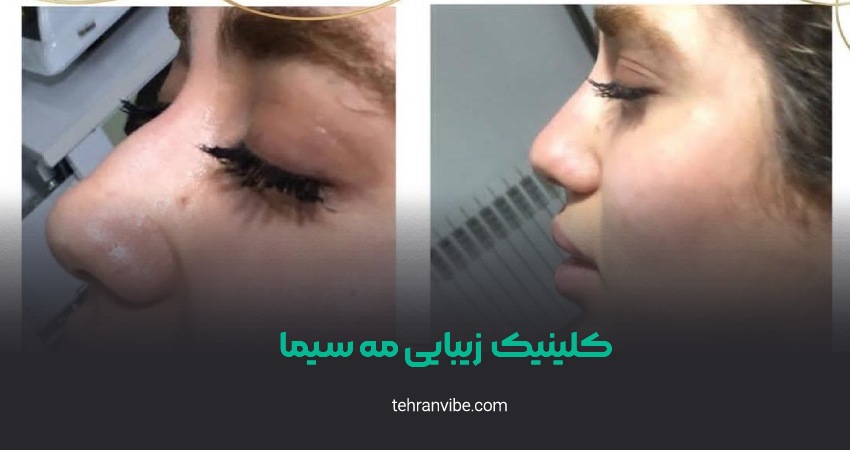 کلینیک زیبایی مه سیما صادقیه