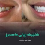 کلینیک زیبایی ماهسرخ آیت الله کاشانی