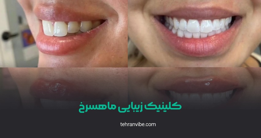کلینیک زیبایی ماهسرخ آیت الله کاشانی