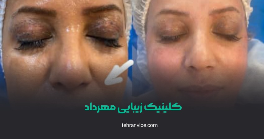کلینیک دکتر مهرداد مرزداران