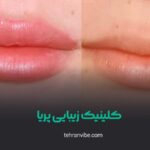 کلینیک زیبایی پریا اکباتان