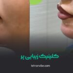 کلینیک زیبایی پر تهرانسر