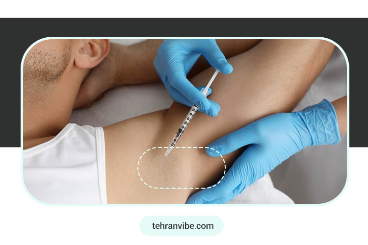 هزینه بوتاکس زیر بغل