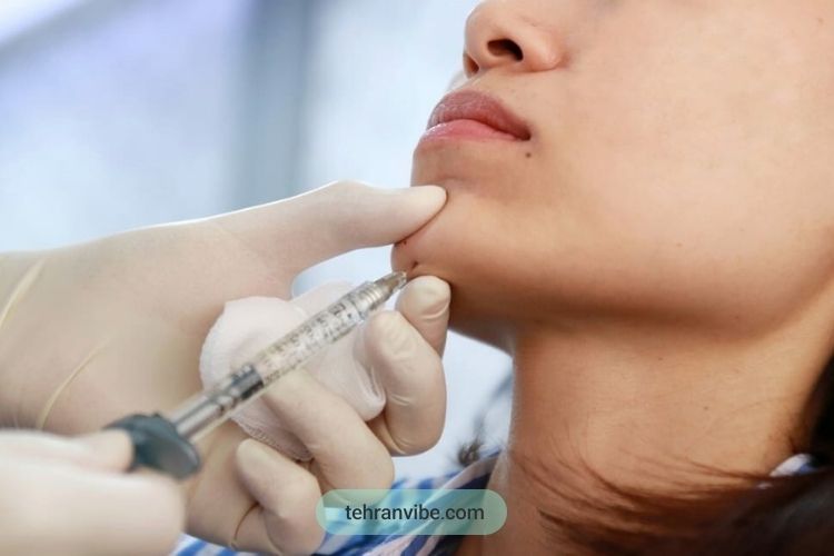 چانه برجسته بدون جراحی