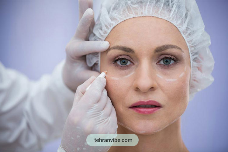 بلفاروپلاستی با لیزر چیست